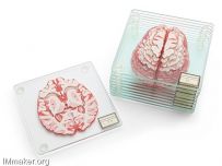 ThinkGeekĴԱ걾Brain Specimen Coasters