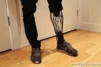 Exo Prosthetic Leg֫